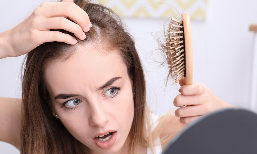Natural Ways You Can Prevent Hair Fall
